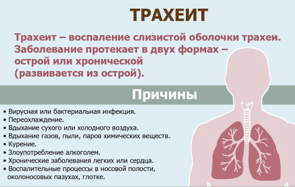 Кашель от соплей у ребенка. Чем лечить при насморке