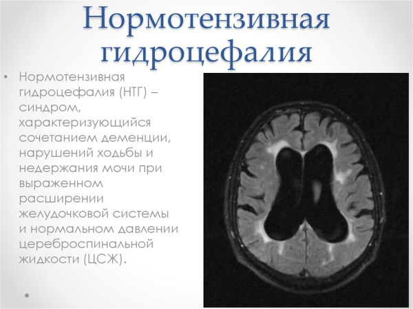 Острая задержка мочи (мочеиспускания). Неотложная помощь, алгоритм