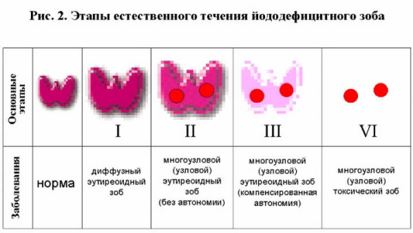 УЗИ щитовидной железы. Что показывает, подготовка