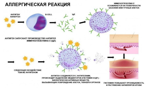 Болит горло только по ночам, а днем не болит