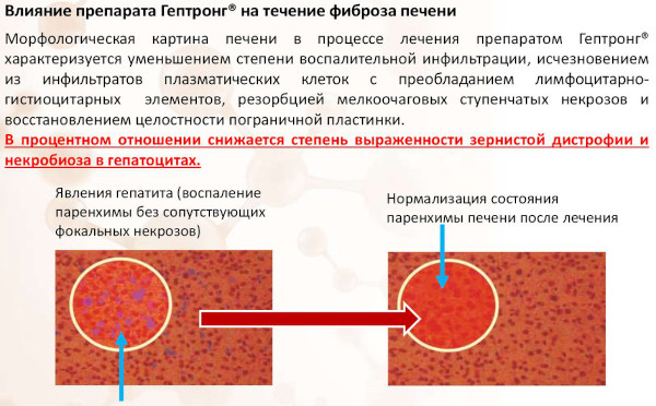 Гептрон Отзывы, инструкция по применению, цена