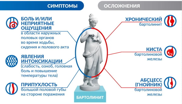 Киста бартолиновой железы. Как лечить, удаление, причины