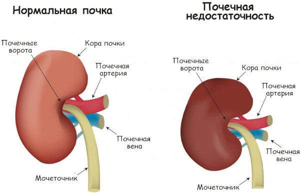 Ледипасвир и Софосбувир. Инструкция по применению, цена