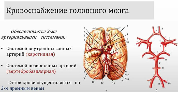 Сосудистые заболевания головного мозга. Симптомы, классификация