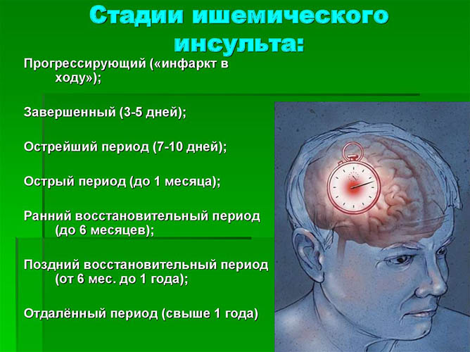 Сосудистые заболевания головного мозга. Симптомы, классификация