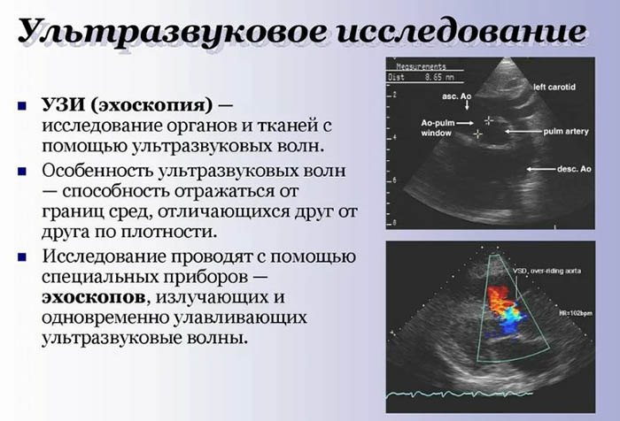 УЗИ кишечника. Как делают, что показывает, подготовка