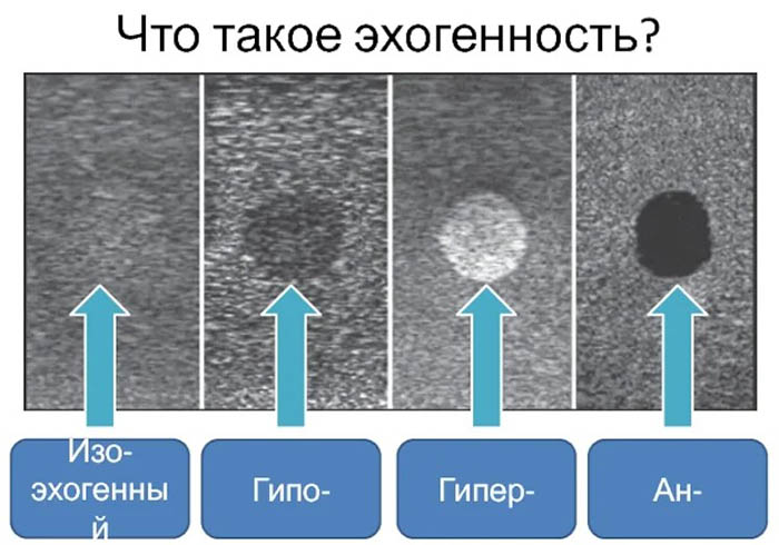 УЗИ кишечника. Как делают, что показывает, подготовка