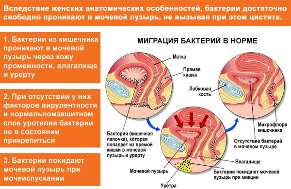 Бактериальный цистит. Лечение у женщин, препараты, симптомы