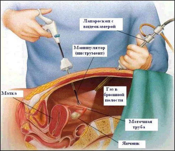 Болит желудок при месячных. Причины, что делать