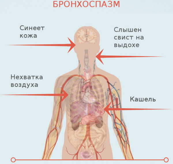 Фукорцин или зеленка от ветрянки. Что лучше, отзывы