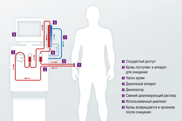 Почему отказывают почки. Что происходит, симптомы, причины