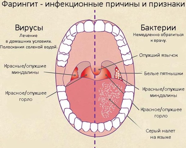 Щелочные ингаляции. Что это такое, Небулайзером, как разводить