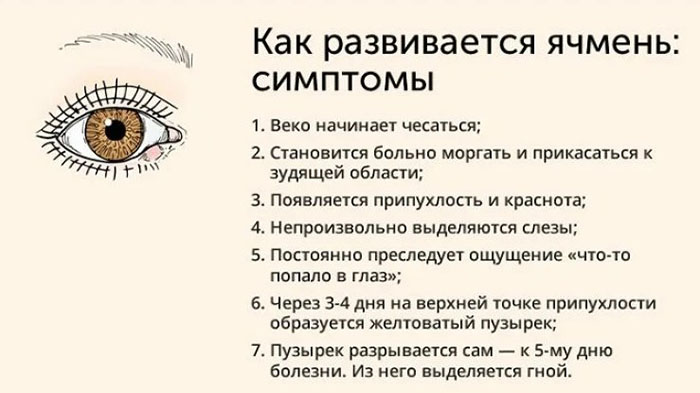 Чирей на глазу. Как лечить: мазь, антибиотики, лекарство