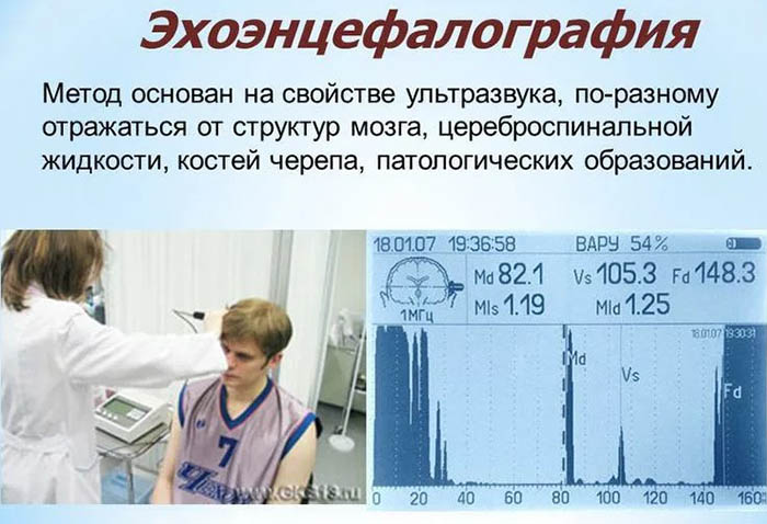 Эхоэнцефалография (ЭХО-ЭГ). Что это такое у детей, как делается