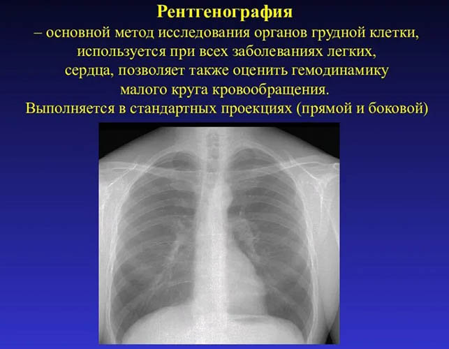 Флюорография и рентген легких. Чем отличается, разница