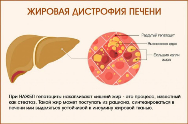 Гептрал или Эссенциале Форте. Что лучше, отзывы