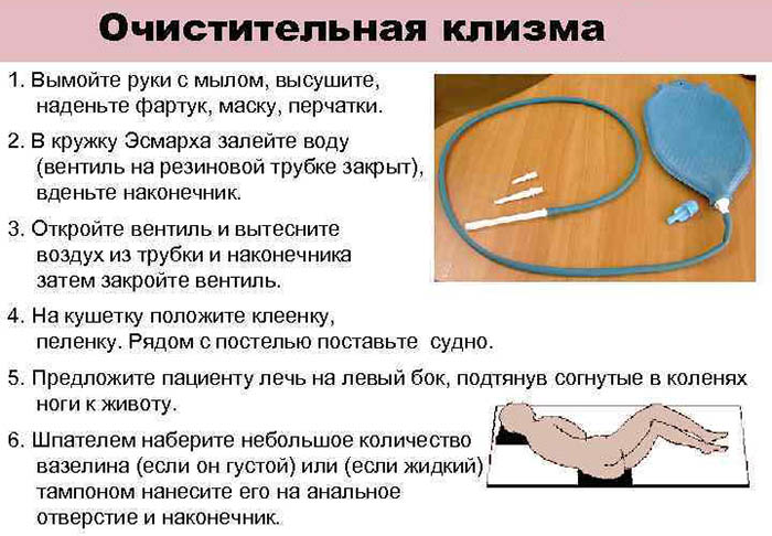 Температура воды для постановки очистительной клизмы при задержке стула спастического генеза