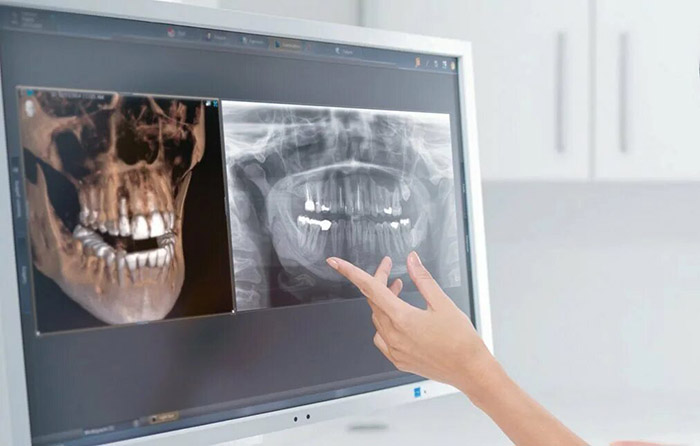 Конусно-лучевая компьютерная томография (КЛКТ) в стоматологии. Цены