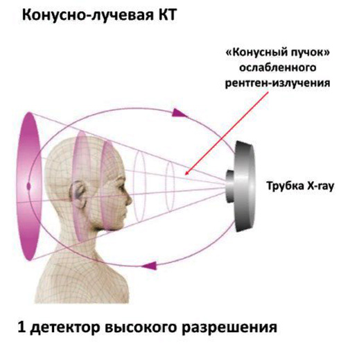 Конусно-лучевая компьютерная томография (КЛКТ) в стоматологии. Цены