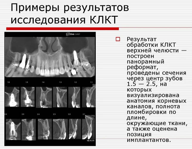 Конусно-лучевая компьютерная томография (КЛКТ) в стоматологии. Цены