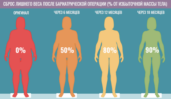 Мини-гастрошунтирование желудка. Что это, цена, отзывы