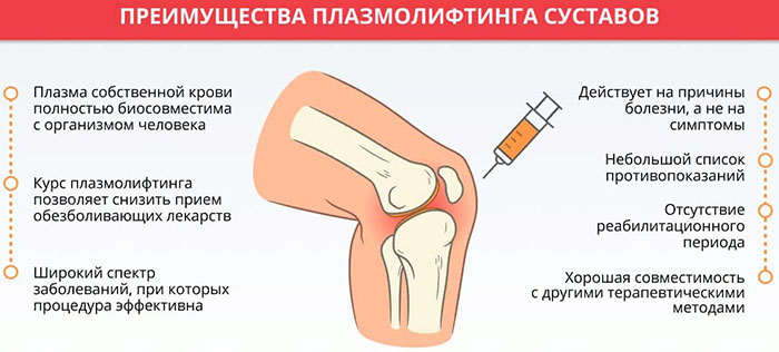 Плазмолифтинг для суставов. Что это такое, отзывы, цена