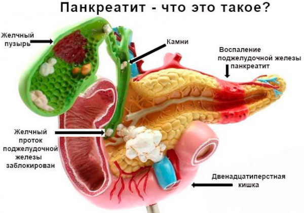 Повышенный (высокий) билирубин в крови у мужчин. Причины