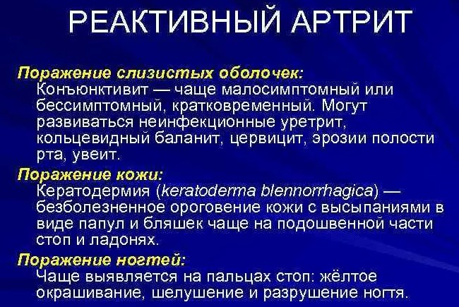 Реактивный артрит. Что это такое, симптомы и лечение