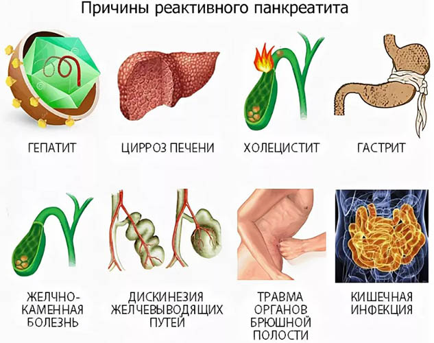 Реактивный панкреатит. Что это такое, лечение, симптомы у взрослых