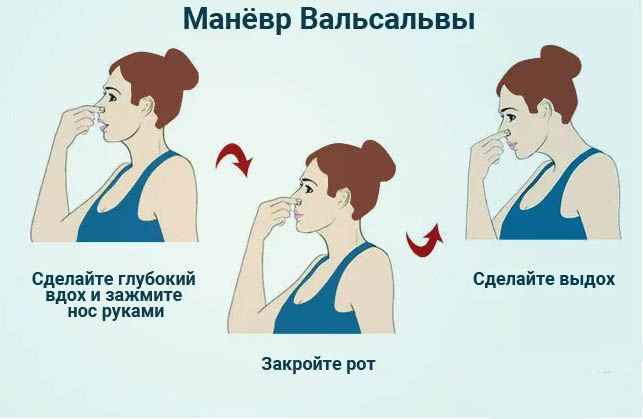 Заложило уши при насморке, простуде. Что делать, как лечить