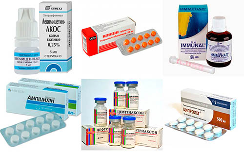 Антибиотики при воспалении лимфоузлов (лимфадените). Лечение, как принимать