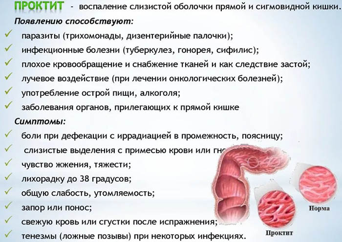 Катаральный проктит. Что это такое, симптомы, лечение