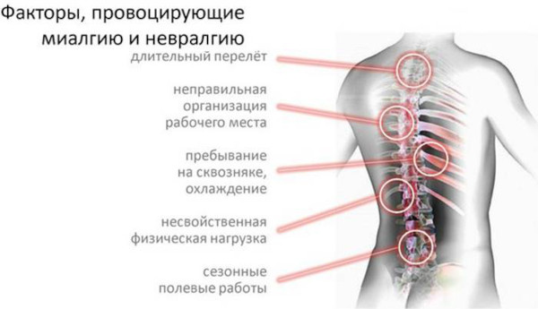 Мышечный спазм в спине, поясничном отделе. Как снять медикаментозно, упражнения