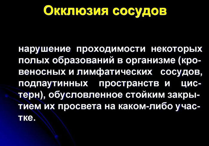 Окклюзия сосудов, артерий нижних конечностей. Что это такое