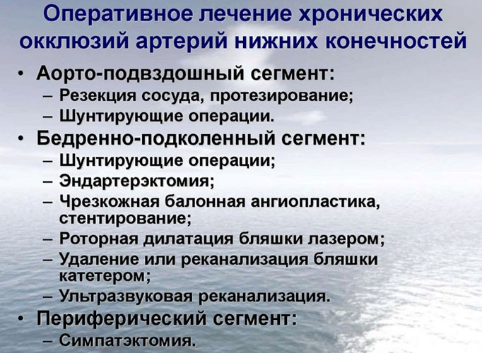 Окклюзия сосудов, артерий нижних конечностей. Что это такое