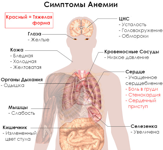 Псориаз ногтей (ониходистрофия) на ногах, руках. Фото, лечение