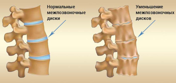 Рентген копчика. Подготовка, как делают, цена