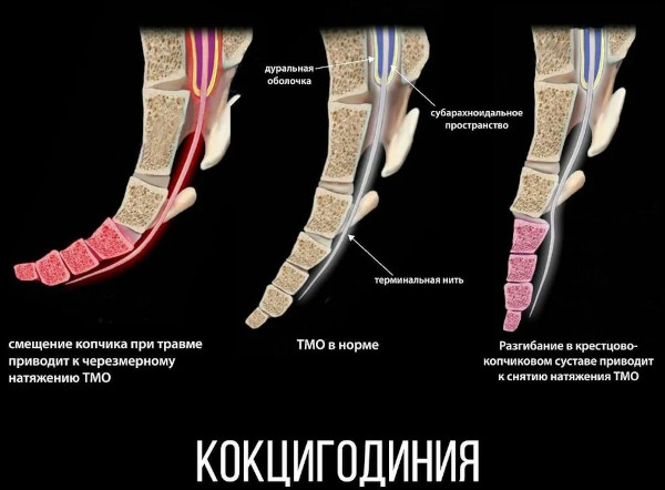 Рентген копчика. Подготовка, как делают, цена