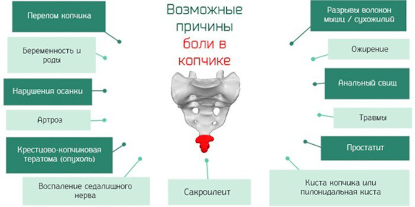 Рентген копчика. Подготовка, как делают, цена