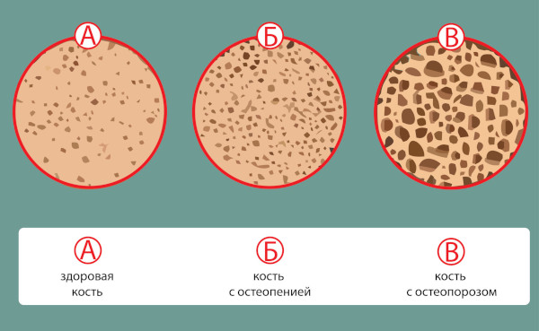 Рентген тазобедренных суставов. Подготовка у взрослых, детей