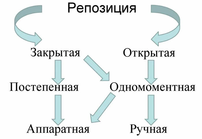 Репозиция костей. Что это такое: закрытая, открытая, техника операции