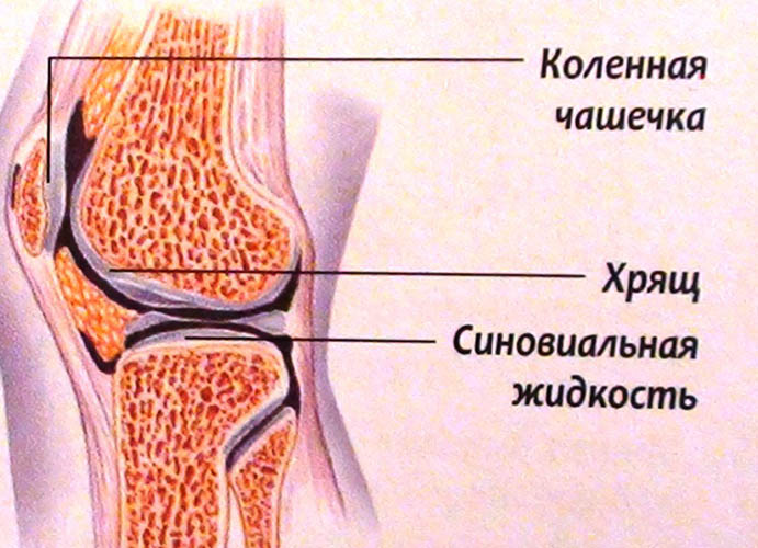 Синовиальная жидкость в коленном суставе (выпот). Лечение, рентген, препараты