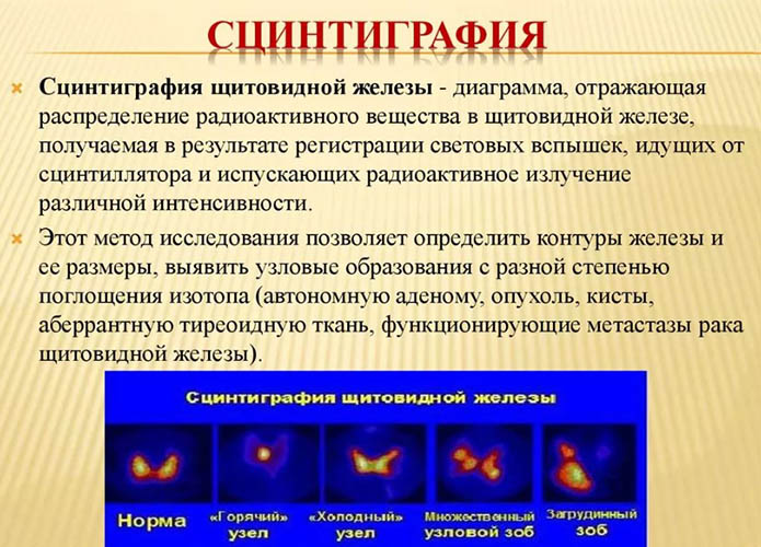 Удаление щитовидки радиоактивным йодом. Отзывы, последствия у женщин