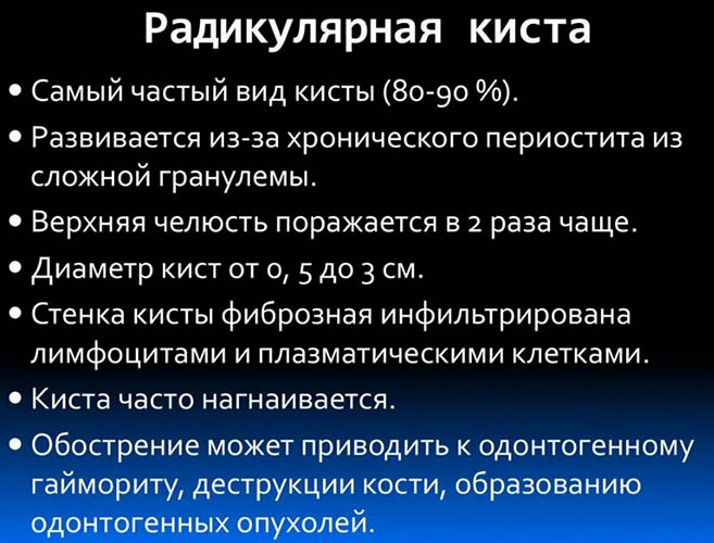 Верхнечелюстная киста пазухи левой, правой, верхней. Что это такое