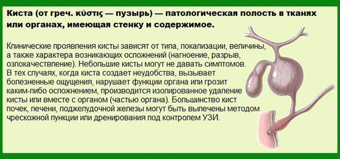 Верхнечелюстная киста пазухи левой, правой, верхней. Что это такое