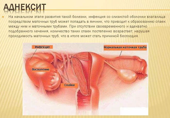 Жжение в животе внизу. Причины у женщин, мужчин