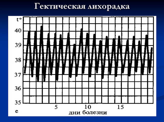 Гектическая лихорадка. Что это, причины, заболевания, как наступает