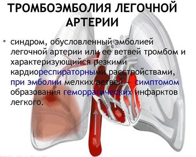 Реканализация. Что это такое: тромба, вен, сосудов