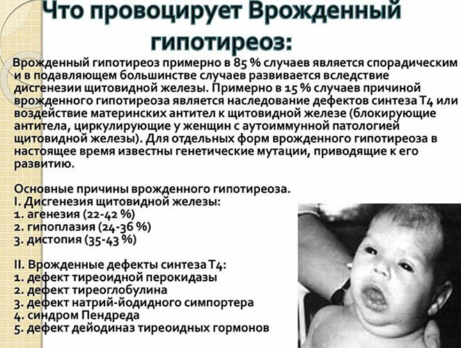 Врожденный гипотиреоз у новорожденных, грудничка. Симптомы и лечение