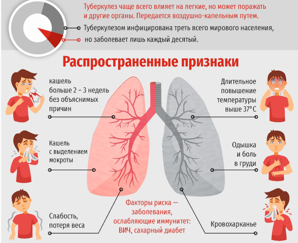 Флюорография. Противопоказания